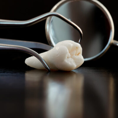 Real Human Wisdom teeth and Dental instruments
