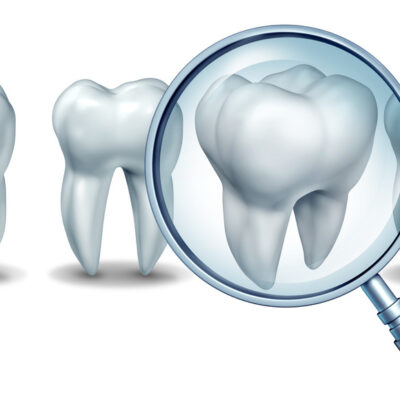 Best dental care concept as a group of teeth with one molar tooth in a magnifying glass as a patient choice for choosing a dentist and dentistry clinic or oral surgeon on a white background.